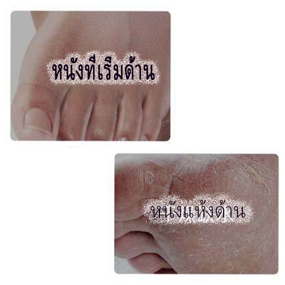 ชุดถุงเท้าสปาอบเท้า Foot Care 1 ซองบรรจุ1คู่เพื่อปรับสภาพผิวที่เนียนนุ่ม สินค้าพร้อมส่ง