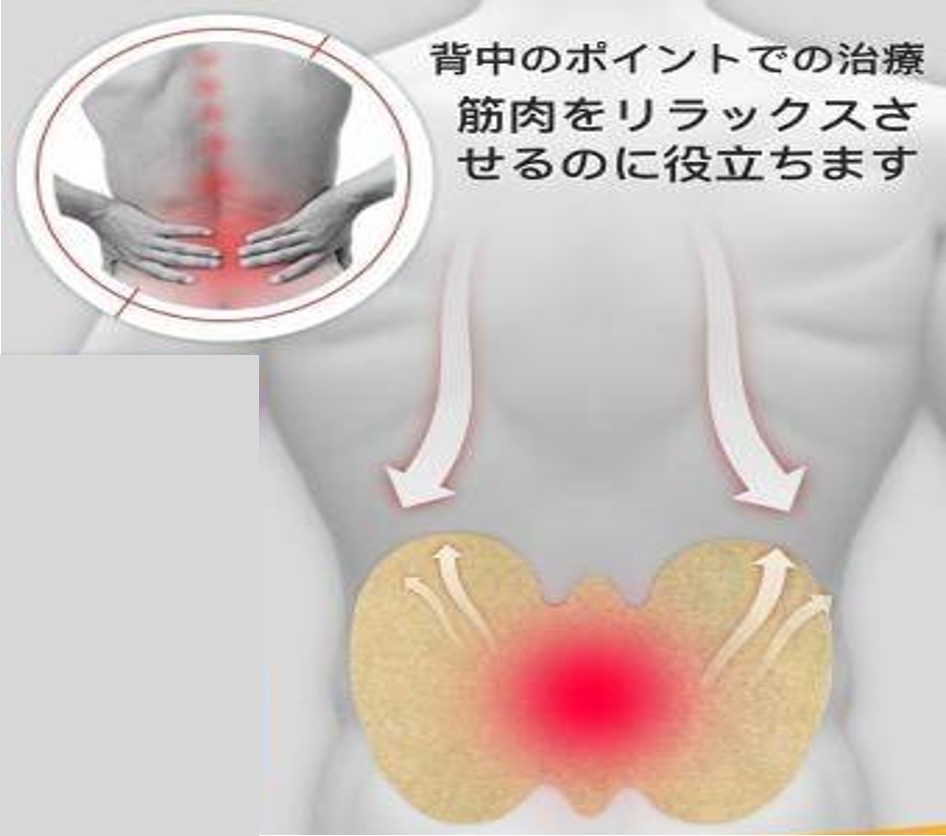 แผ่นแปะผ่อนคลายปวดเมื่อยกล้ามเนื้อบริเวณหลังและเอวพร้อมส่ง