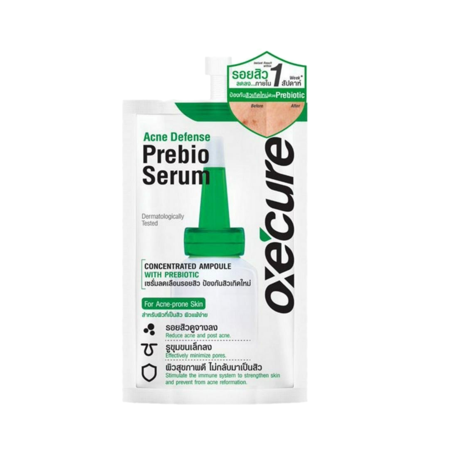 Oxe cure Acne defense prebio serum 5ml.