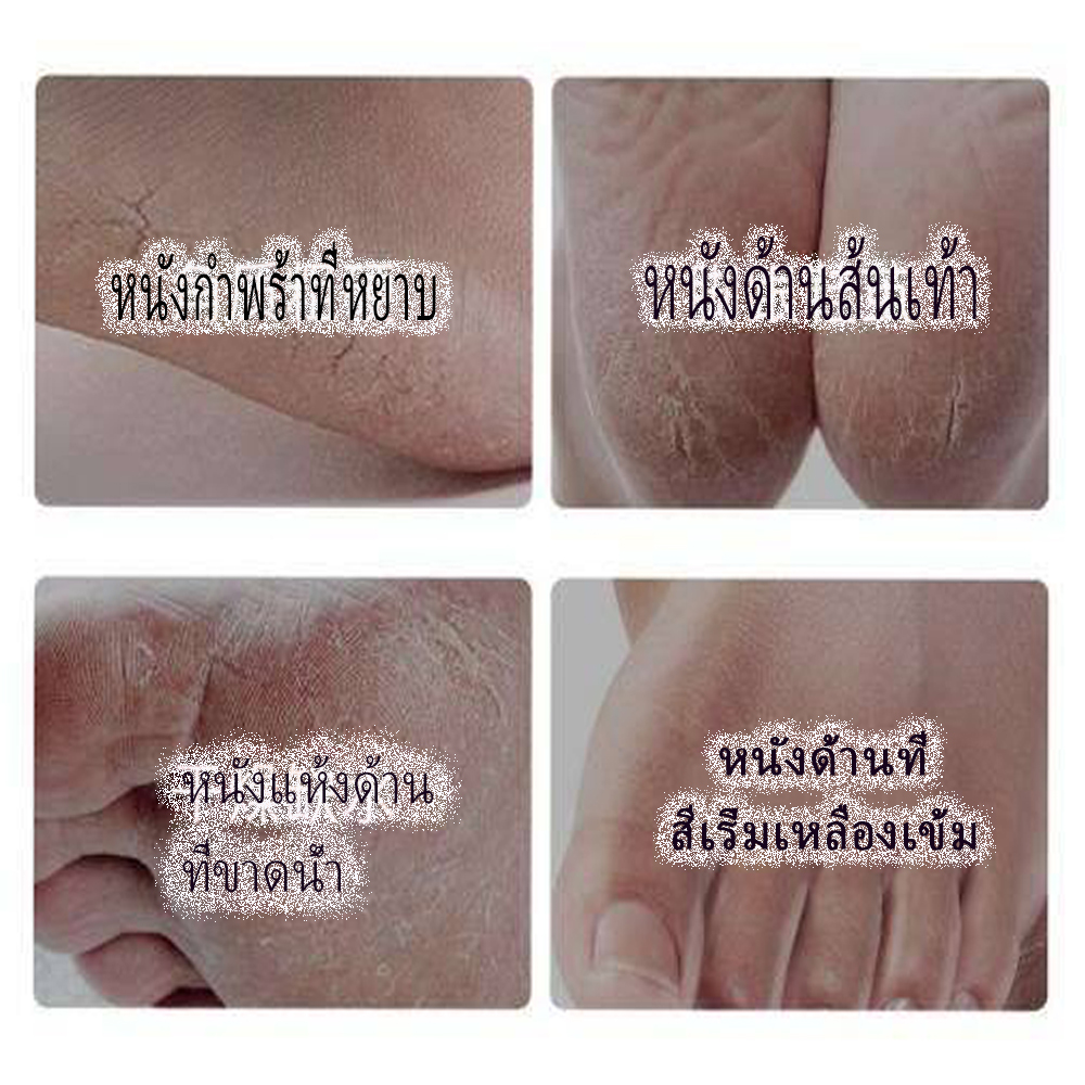 ชุดถุงเท้าสปาอบเท้า Foot Care 1 ซองบรรจุ1คู่เพื่อปรับสภาพผิวที่เนียนนุ่ม สินค้าพร้อมส่ง