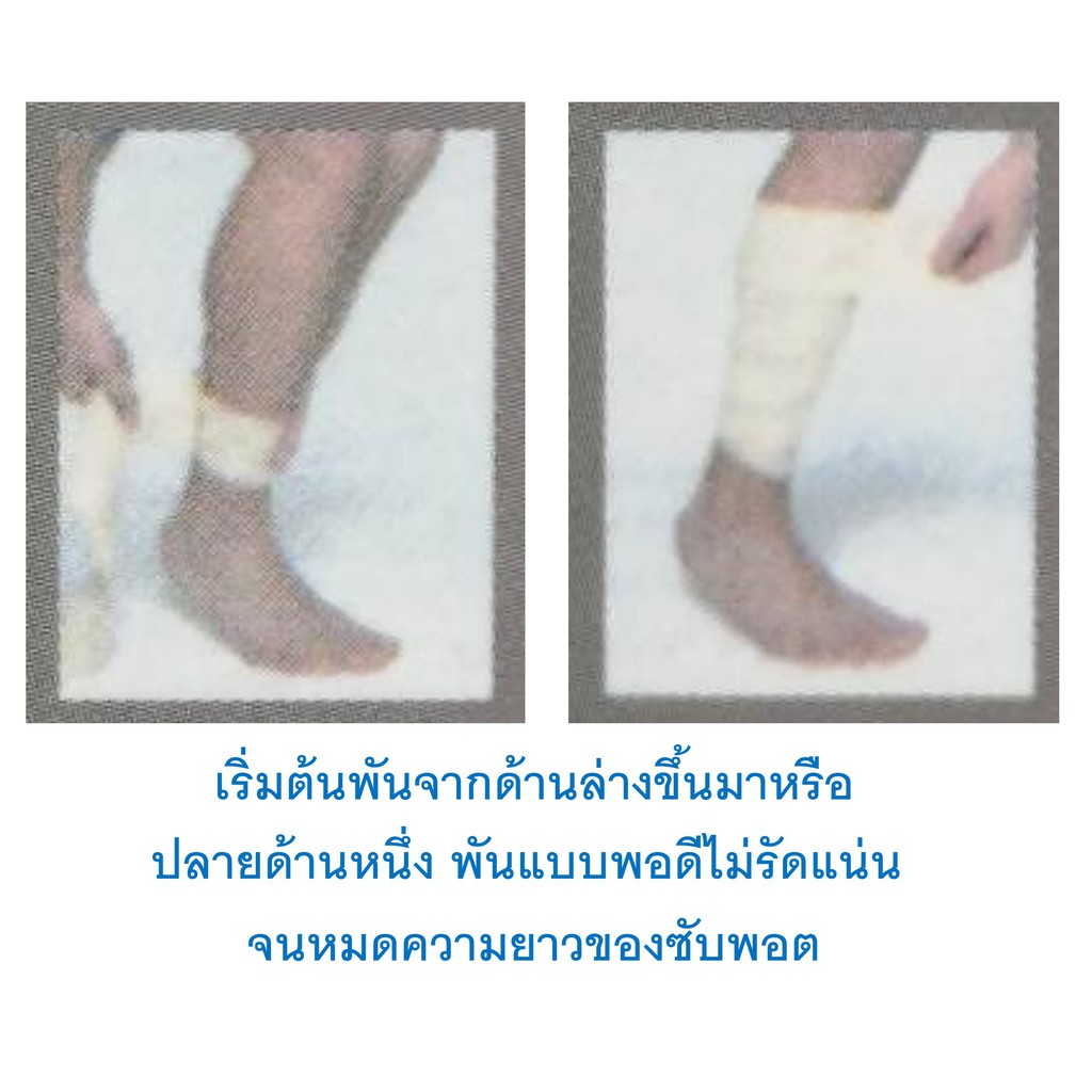 ผ้ารัดกล้ามเนื้อน่องขา