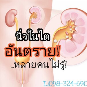 นิ่วในไตเกิดขึ้นได้เพราะ?