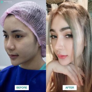 ศัลยกรรมทำนม โทร 095-5266242 เสริมหน้าอก เสริมจมูก ทำตา2ชั้น สำหรับผู้หญิงเรา ต้องสวย เพราะความสวยจะเปลี่ยนชีวิต